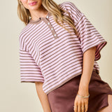 Sugar Rush Stripe Top